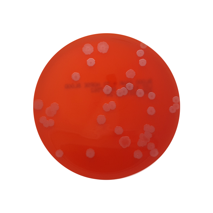 Blood Agar Base with 5% Defibrinated Horse Blood, 90mm Plate