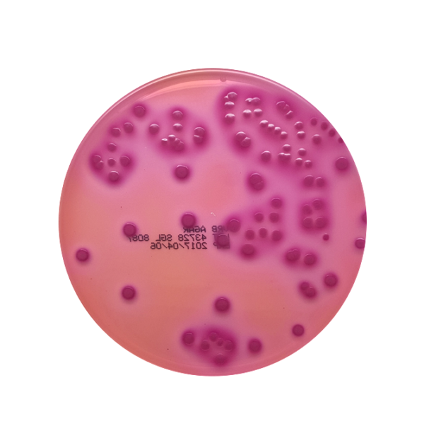 Escherichia Coli