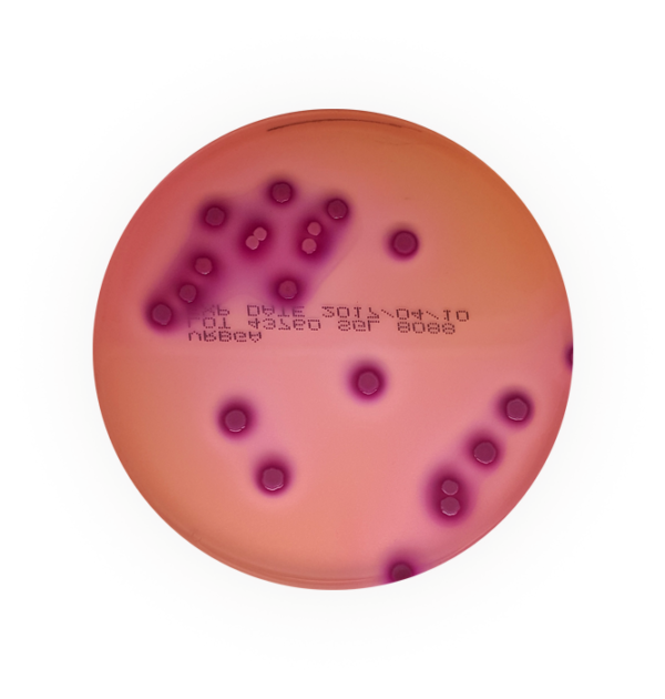 Escherichia Coli