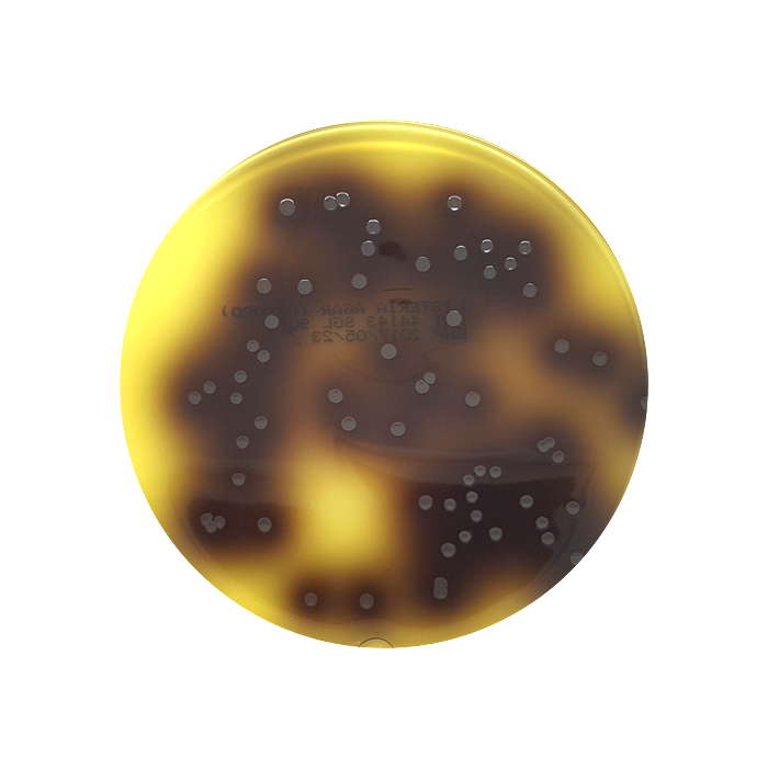 Listeria Selective Agar (OXFORD), 90mm Plate