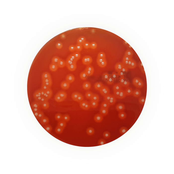 Columbia Blood agar + Colistin Sulphate, Nalidixic Acid (CNA) Staphylococcus/Streptococcus Selective Agar, 90mm Plate